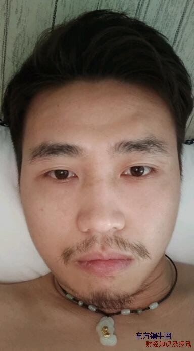 戒煙一年前后對(duì)比照